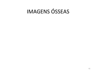 82
IMAGENS ÓSSEAS
 