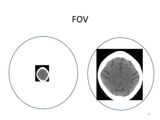 85
FOV
 