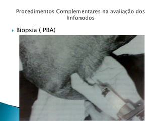  Biopsia ( PBA)
 
