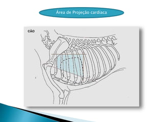 Área de Projeção cardíaca
 