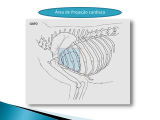 Área de Projeção cardíaca
 