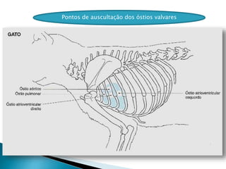 Pontos de auscultação dos óstios valvares
 