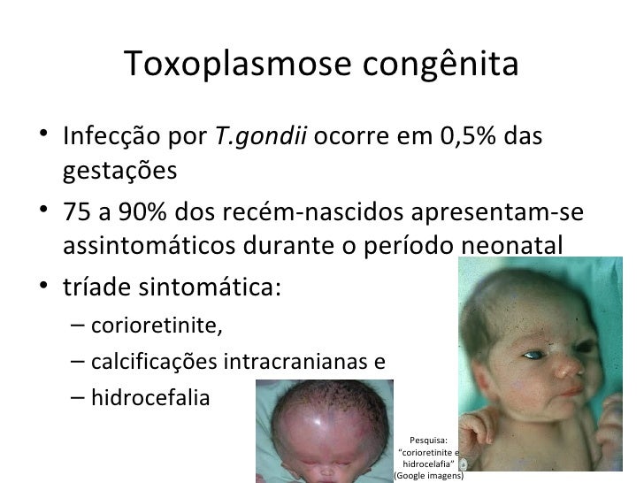 Aula toxoplasmose