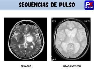 Tudo sobre Ressonância Magnética (RM) | PDF