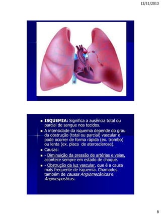 13/11/2013
8
 ISQUEMIA: Significa a ausência total ou
parcial de sangue nos tecidos.
 A intensidade da isquemia depende do grau
da obstrução (total ou parcial) vascular e
pode ocorrer de forma rápida (ex. trombo)
ou lenta (ex. placa de aterosclerose).
 Causas:
 - Diminuição da pressão de artérias e veias,
acontece sempre em estado de choque.
 - Obstrução da luz vascular, que é a causa
mais frequente de isquemia. Chamados
também de causas Angiomecânicas e
Angioespastícas.
 
