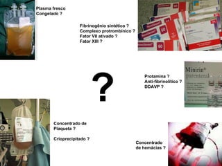 ? Plasma fresco Congelado ? Concentrado de  Plaqueta ? Crioprecipitado ? Protamina ? Anti-fibrinolítico ? DDAVP ? Concentrado de hemácias ? Fibrinogênio sintético ? Complexo protrombínico ? Fator VII ativado ? Fator XIII  ? 