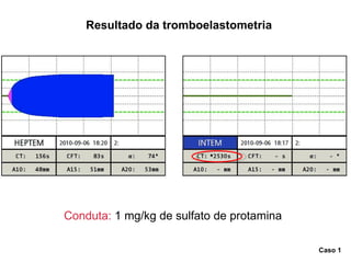 Conduta:  1 mg/kg de sulfato de protamina Resultado da tromboelastometria Caso 1 