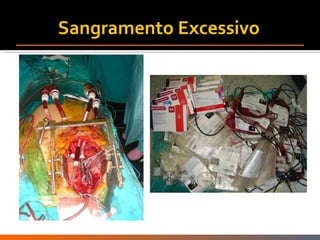 Sangramento Excessivo  