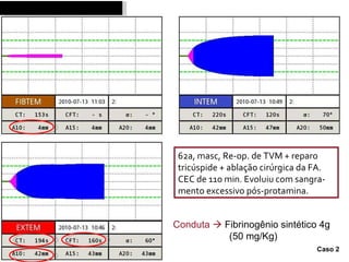62a, masc, Re-op. de TVM + reparo tricúspide + abla ç ão cirúrgica da FA.  CEC de 110 min. Evoluiu com sangra- mento excessivo pós-protamina. Conduta     Fibrinogênio sintético 4g (50 mg / Kg) Caso 2 