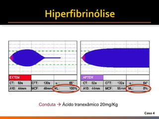 Conduta     Ácido tranexâmico 20mg/Kg Caso 4 