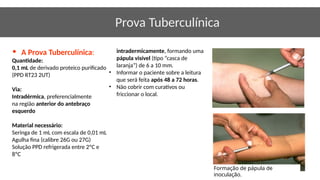 Aula sobre Tuberculose para enfermeiros_ | PPTX