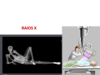 Raios X