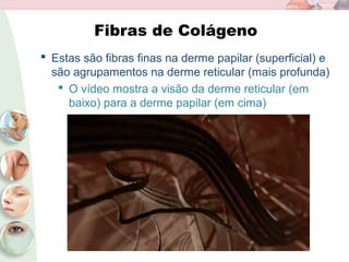 Fibras de Colágeno
 Estas são fibras finas na derme papilar (superficial) e
são agrupamentos na derme reticular (mais profunda)
 O vídeo mostra a visão da derme reticular (em
baixo) para a derme papilar (em cima)
 