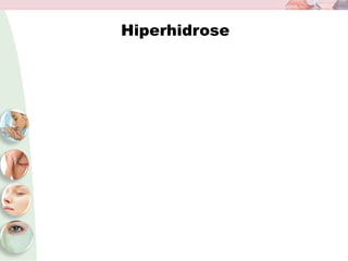 Hiperhidrose
 