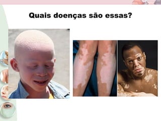 Quais doenças são essas?
 