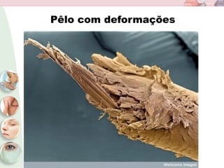 Pêlo com deformações
 