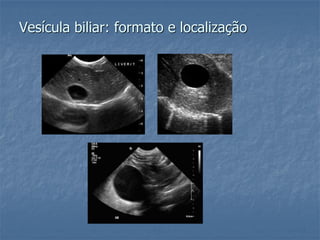 Vesícula biliar: formato e localização
 