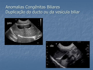 Anomalias Congênitas Biliares
Duplicação do ducto ou da vesícula biliar
gato
cão
 