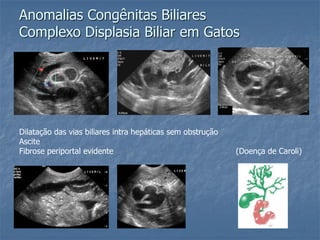 Anomalias Congênitas Biliares
Complexo Displasia Biliar em Gatos
Dilatação das vias biliares intra hepáticas sem obstrução
Ascite
Fibrose periportal evidente (Doença de Caroli)
 