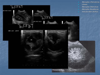  Alterações inflamatórias
 Litíases
 Alterações Obstrutivas
 Alterações Neoplásicas
 Vesícula biliar atrófica
 