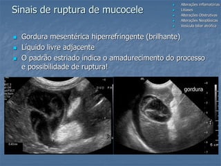  Alterações inflamatórias
 Litíases
 Alterações Obstrutivas
 Alterações Neoplásicas
 Vesícula biliar atrófica
Sinais de ruptura de mucocele
 Gordura mesentérica hiperrefringente (brilhante)
 Líquido livre adjacente
 O padrão estriado indica o amadurecimento do processo
e possibilidade de ruptura!
gordura
 