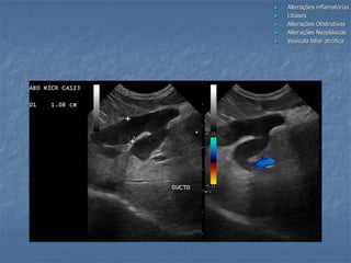  Alterações inflamatórias
 Litíases
 Alterações Obstrutivas
 Alterações Neoplásicas
 Vesícula biliar atrófica
 