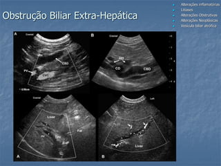  Alterações inflamatórias
 Litíases
 Alterações Obstrutivas
 Alterações Neoplásicas
 Vesícula biliar atrófica
Obstrução Biliar Extra-Hepática
 