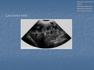 Fonte: Nyland, 2004
 Alterações inflamatórias
 Litíases
 Alterações Obstrutivas
 Alterações Neoplásicas
 Vesícula biliar atrófica
Carcinoma biliar
 