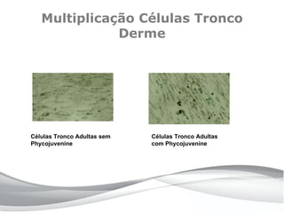 Multiplicação Células Tronco
              Derme




Células Tronco Adultas sem   Células Tronco Adultas
Phycojuvenine                com Phycojuvenine
 