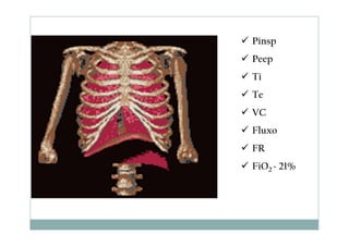 Pinsp
Peep
Ti
Te
VC
Fluxo
FR
FiO2 ~ 21%
 