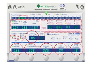 Ventilação mecânica