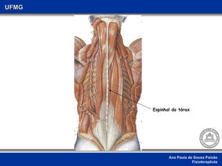 Ana Paula de Sousa Paixão Fisioterapêuta UFMG Espinhal do tórax 