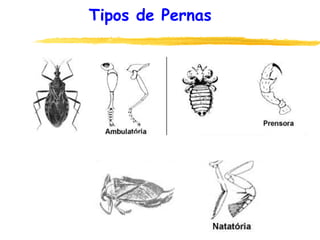 Tipos de Pernas
 