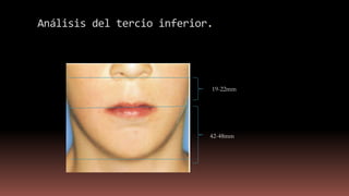 Análisis del tercio inferior.
19-22mm
42-48mm
 