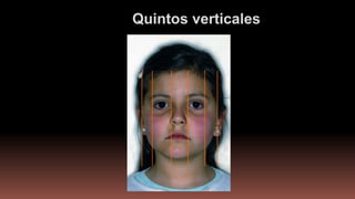 Quintos verticales
 