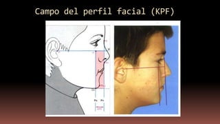 Campo del perfil facial (KPF)
 