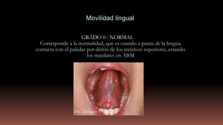 GRADO 0 : NORMAL
Corresponde a la normalidad, que es cuando a punta de la lengua
contacta con el paladar por detrás de los incisivos superiores, estando
los maxilares en ABM
Movilidad lingual
Dra . Damiani P
 