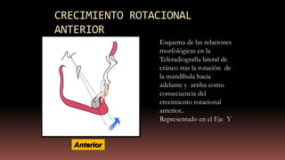 CRECIMIENTO ROTACIONAL
ANTERIOR
Anterior
Esquema de las relaciones
morfológicas en la
Teleradiografía lateral de
cráneo tras la rotación de
la mandíbula hacia
adelante y arriba como
consecuencia del
crecimiento rotacional
anterior..
Representado en el Eje Y
 