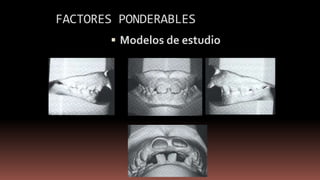 FACTORES PONDERABLES
 Modelos de estudio
 