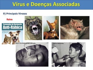 Vírus e Doenças Associadas
9) Principais Viroses
Raiva
 