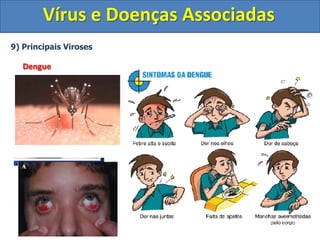 Vírus e Doenças Associadas
9) Principais Viroses
Dengue
 
