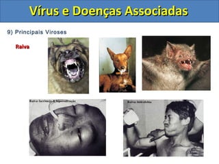 Vírus e Doenças AssociadasVírus e Doenças Associadas
9) Principais Viroses
RaivaRaiva
 