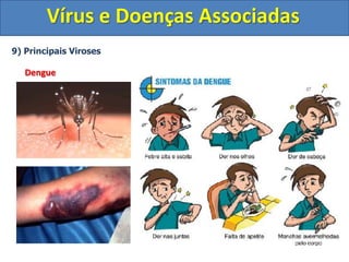Vírus e Doenças Associadas
9) Principais Viroses
Dengue
 