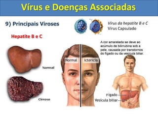 Vírus e Doenças Associadas
9) Principais Viroses
Hepatite B e C
Vírus da hepatite B e C
Vírus Capsulado
 