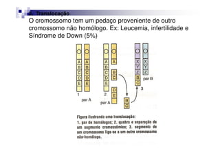 2. Translocação
O cromossomo tem um pedaço proveniente de outro
cromossomo não homólogo. Ex: Leucemia, infertilidade e
Síndrome de Down (5%)
 