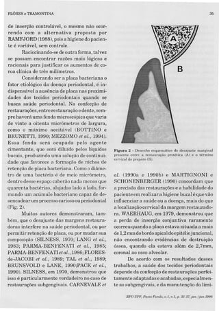 FLÔRES e TRAMONTINA
de inserção controlável, o mesmo não ocor-
rendo com a alternativa proposta por
RAMFJORD (1988), pois a higiene dopacien-
te é variável, sem controle.
Raciocinando-se de outra forma, talvez
se possam encontrar razões mais lógicas e
racionais para justificar os aumentos de co-
roa clínica de três milímetros.
Considerando ser a placa bacteriana o
fator etiológico da doença periodontal, é in-
dispensável a ausência de placa nas proximi-
dades dos tecidos periodontais quando se
busca saúde periodontal. Na confecção de
restaurações, entre restauração e dente, sem-
pre haverá uma fenda microscópica que varia
de vinte a oitenta micrômetros de largura,
como o máximo aceitável (BOTTINO e
BRUNETTI, 1990; MEZZOMO et al., 1994).
Essa fenda será ocupada pelo agente
cimentante, que será diluído pelos líquidos
bucais, produzindo uma solução de continui-
.zlade .que.favorece a formação de nichos de
retenção de placa bacteriana. Como o diâme-
tro de uma bactéria é de meio micrômetro,
dentro desse espaço caberão nada menos que
quarenta bactérias, alojadas lado a lado, for-
mando um acúmulo bacteriano capaz de de-
sencadear um processo carioso ou periodontal
(Fig.2).
Muitos autores demonstraram, tam-
bém, que o desajuste das margens restaura-
doras interfere na saúde periodontal, ou por
permitir retenção de placa, ou por mudar sua
composição (SILNESS, 1970; LANG et al.,
1983; PARMA-BENFENATI et al., 1985;
PARMA-BENFENATletal., 1986;FLORES-
de-JACOBI et al., 1989; TAL et al., 1989;
BRUNSVOLD e LANE, 1990;PACK et al.,
1990). SILNESS, em 1970, demonstrou que
isso é particularmente verdadeiro no caso de
restaurações subgengivais. CARNEVALE et
35
Figura 2 - Desenho esquemático do desajuste marginal
presente entre a restauração protética CA) e o término
cervical do preparo (B).
alo (1990a e 1990b) e MARTIGNONI e
SCHONENBERGER (1990) concordam que
a precisão das restaurações e a habilidade do
paciente em realizar a higiene bucal é que vão
influenciar a saúde ou a doença, mais do que
a localização cervical da margem restaurado-
ra.W AERHAUG, em 1979, demonstrou que
a perda de inserção conjuntiva raramente
ocorreu quando a placa estava situada a mais
de 1,2mm dobordoapical doepitéliojuncional,
não encontrando evidências de destruição
óssea, quando ela estava além de 2,7mm,
coronal ao osso alveolar.
De acordo com os resultados desses
trabalhos, a saúde dos tecidos periodontais
depende da confecçãode restaurações perfei-
tamente adaptadas e acabadas, especialmen-
te as subgengivais, e da manutenção do limi-
RFO UPF, Passo Fundo, v.l, n.I, p. 31-37, jan. /jun. 1996
 