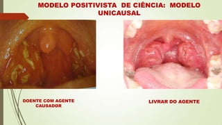 DOENTE COM AGENTE
CAUSADOR
LIVRAR DO AGENTE
MODELO POSITIVISTA DE CIÊNCIA: MODELO
UNICAUSAL
 