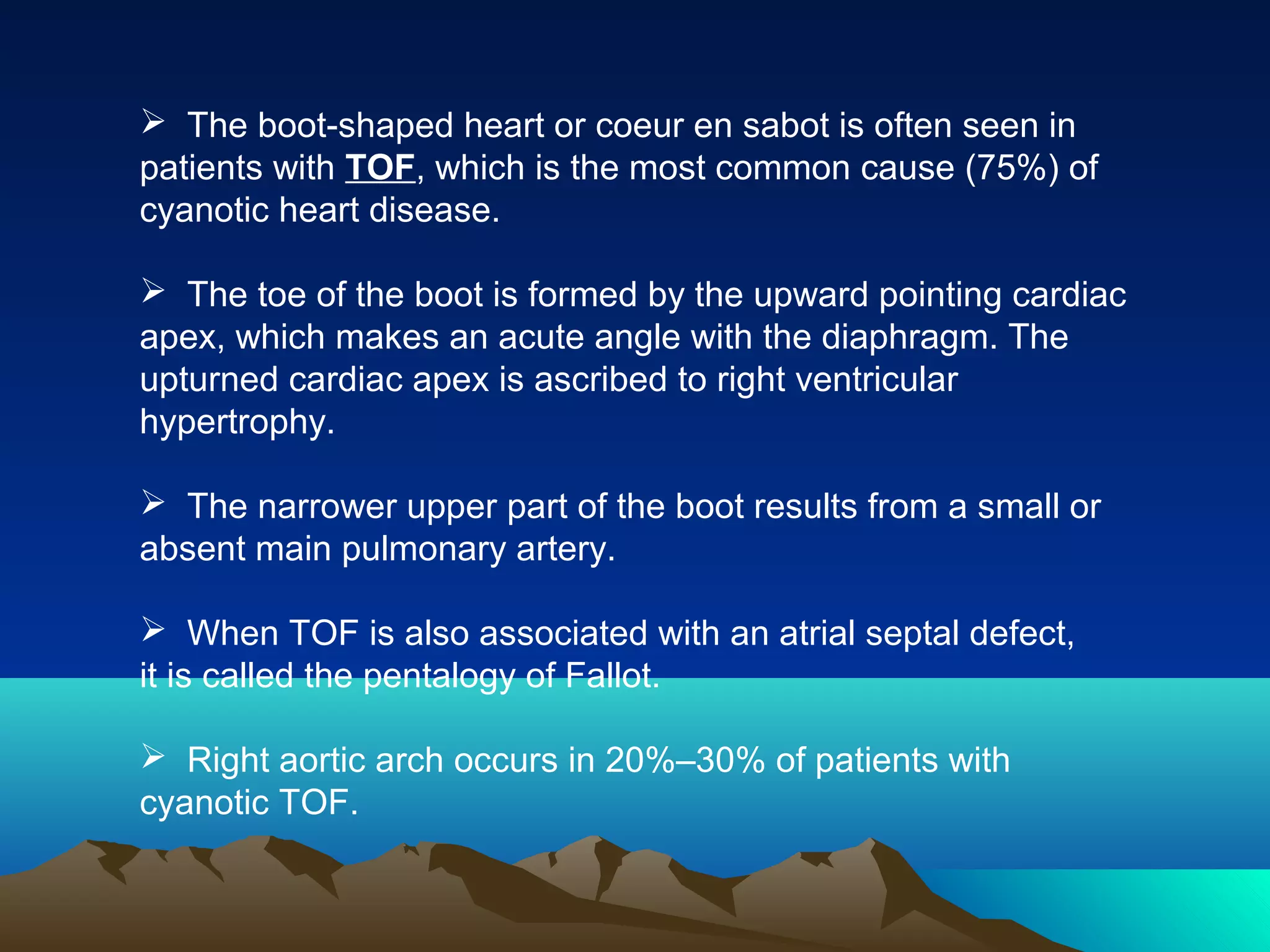 Radiology signs | PPT