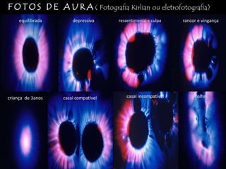 F O T O S D E A U R A ( Fotografia Kirlian ou eletrofotografia)ou
equilibrada

criança de 3anos

depressiva

casal compatível

ressentimento e culpa

casal incompatível

rancor e vingança

folha

 