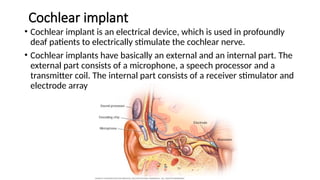 Aural rehabilitation it's components and different types of hearing ...